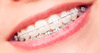 Metody leczenia zębów